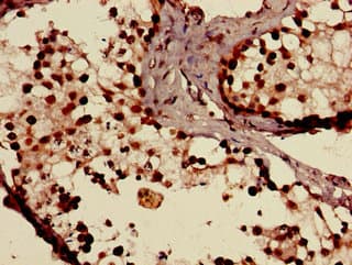Polyclonal Rabbit anti-Human SLCO1C1 / OATPF Antibody (IHC, IF)