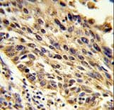 Polyclonal Rabbit anti-Human TRIP13 Antibody (aa64-90, IHC, WB)