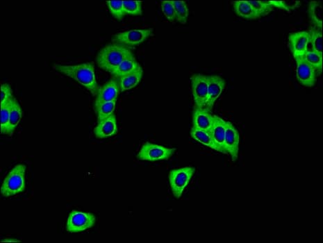 SLC28A3 Antibody