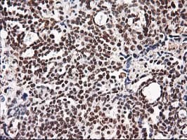 NUDT18 Antibody (clone OTI5D7)