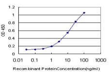 Monoclonal Mouse anti-Human LIMK1 / LIMK Antibody (clone 1B2, WB)