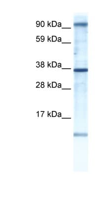 Polyclonal Rabbit anti-Human AKAP7 Antibody (N-Terminus, IHC, WB)