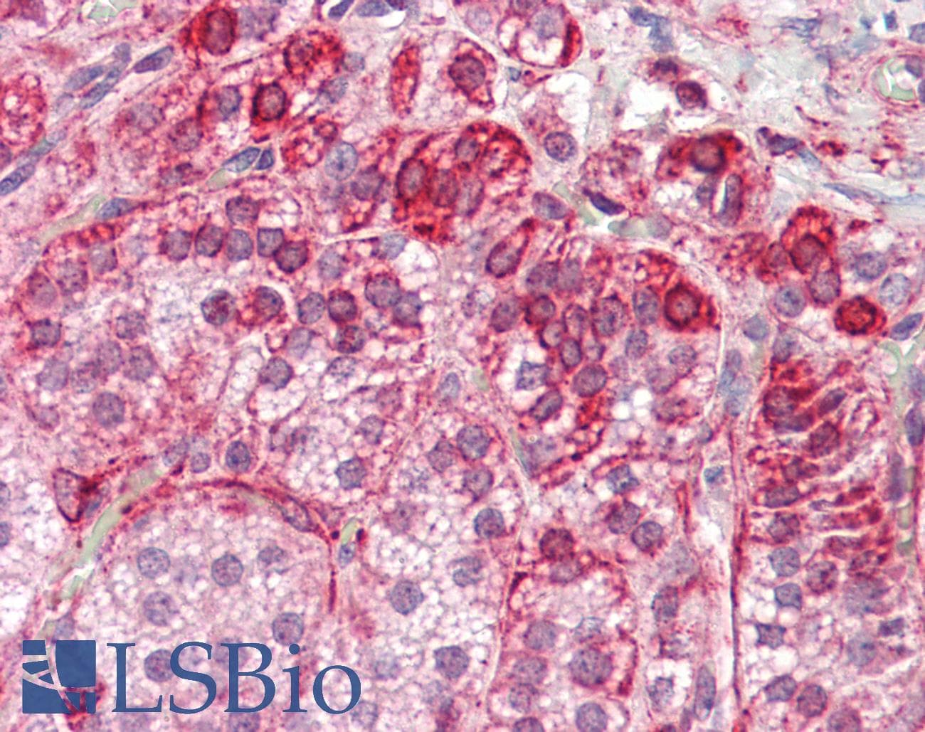 IHC-plus™ Polyclonal Rabbit anti-Human RILP Antibody (IHC, IF, WB)