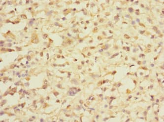 DDX59 Antibody