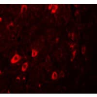 IHC-plus™ Polyclonal Rabbit anti-Human ZBTB3 Antibody (IHC, IF, WB)