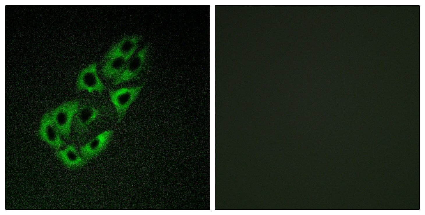 Polyclonal Rabbit anti-Human SSBP1 / mtSSB Antibody (IHC, IF, WB)