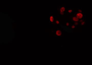 Polyclonal Rabbit anti-Human ER81 / ETV1 Antibody (IF, WB)