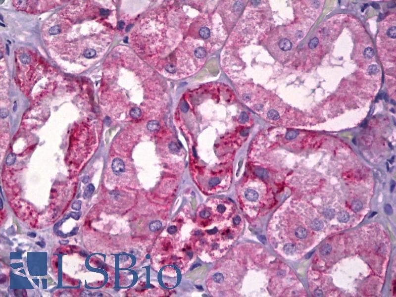 IHC-plus™ CDH6 / K Cadherin Antibody (clone 2B6)