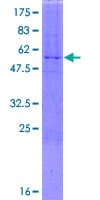 Human PLD6 / Phospholipase D6 Protein (Recombinant GST)