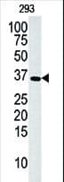 DGUOK / Deoxyguanosine Kinase Antibody (aa1-30)