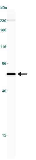 VCAM1 / CD106 Antibody (clone 6G9)