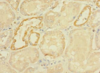 DHX32 Antibody