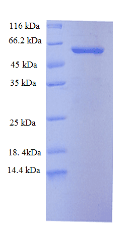Human KRT6A / CK6A / Cytokeratin 6A Protein (Recombinant His)