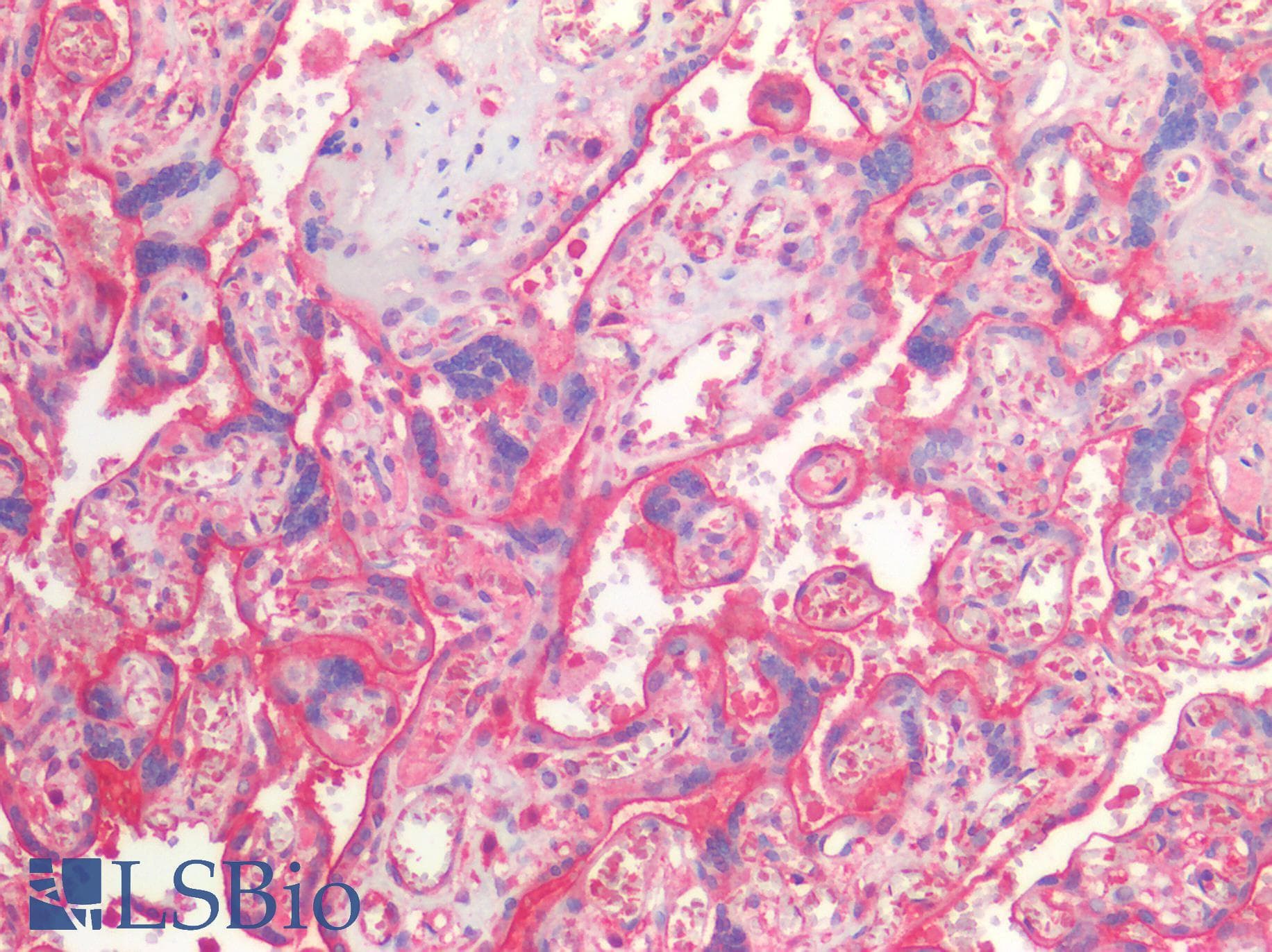 IHC-plus™ Polyclonal Rabbit anti-Human THBD / CD141 / Thrombomodulin Antibody (IHC, WB)
