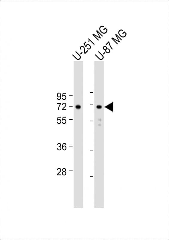 Polyclonal Rabbit anti-Human APLP1 / APLP-1 Antibody (C-Terminus, WB)