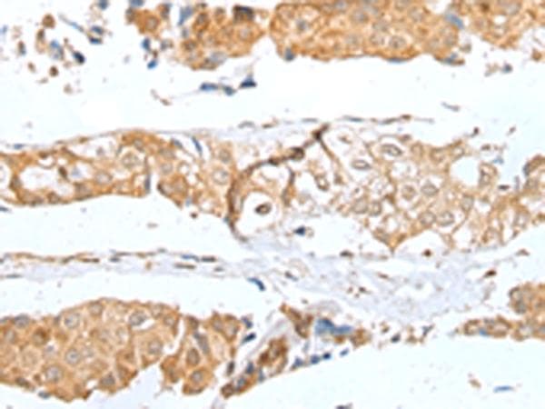 GLIPR1L1 Antibody