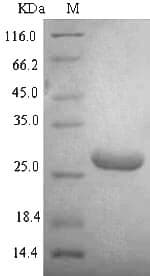 Escherichia coli hupA Protein (Recombinant 6His-SUMO, N-terminus)