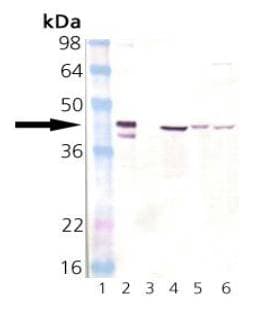 IHC-plus™ Polyclonal Rabbit anti-Human HSP40 Antibody (IHC, WB)