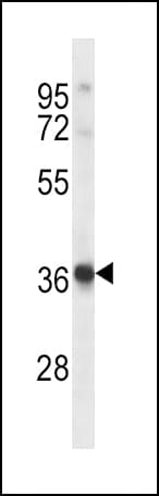 HRH2 / Histamine H2 Receptor Antibody (aa189-218)