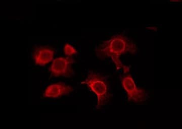 Polyclonal Rabbit anti-Human ADGRF4 / GPR115 Antibody (IF, WB)