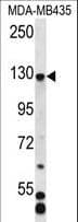 CFAP69 Antibody (aa150-178)