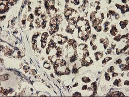 CLPP Antibody (clone OTI1G9)