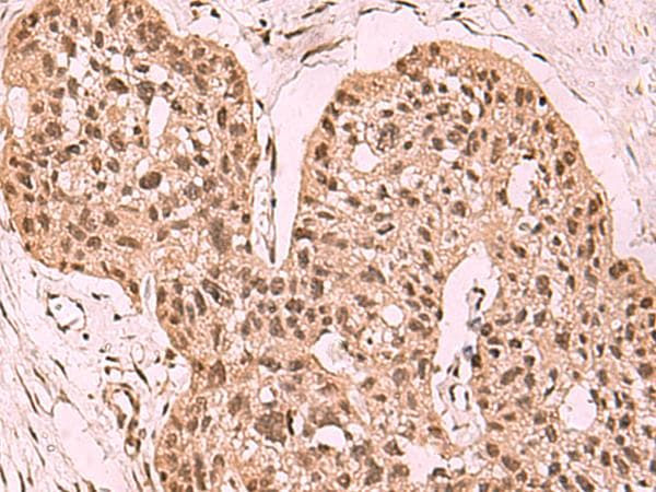 ESET / SETDB1 Antibody