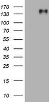 Monoclonal Mouse anti-Human EGFR Antibody (clone OTI8E6, aa900-1210, WB)