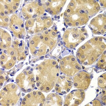 TERE1 / UBIAD1 Antibody