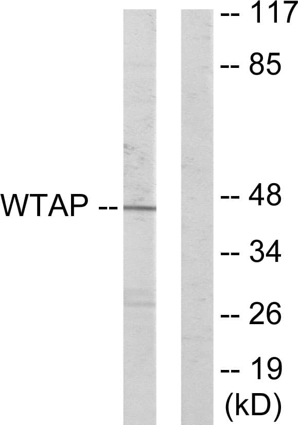 WTAP Antibody (aa321-370)