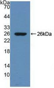 SERPINA10 / PZI Antibody (aa278-425)