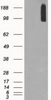 Monoclonal Mouse anti-Human BRAF / B-Raf Antibody (clone OTI1G6, IHC, WB)