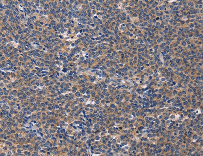 AIM / CD5L Antibody