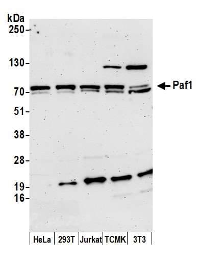 IHC-plus™ PD2 / PAF1 Antibody (aa75-125)