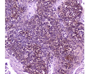 PLCG2 / PLC Gamma 2 Antibody
