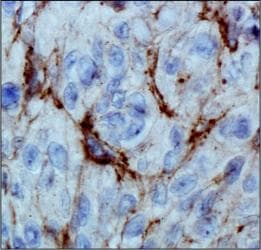EGLN3 / PHD3 Antibody (clone EG188e/d5)