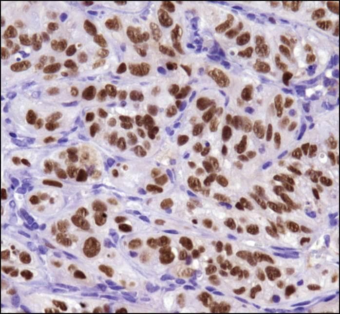 BIRC5 / Survivin Antibody (clone 8E2)