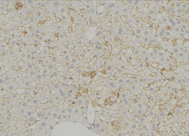 SLC16A11 Antibody