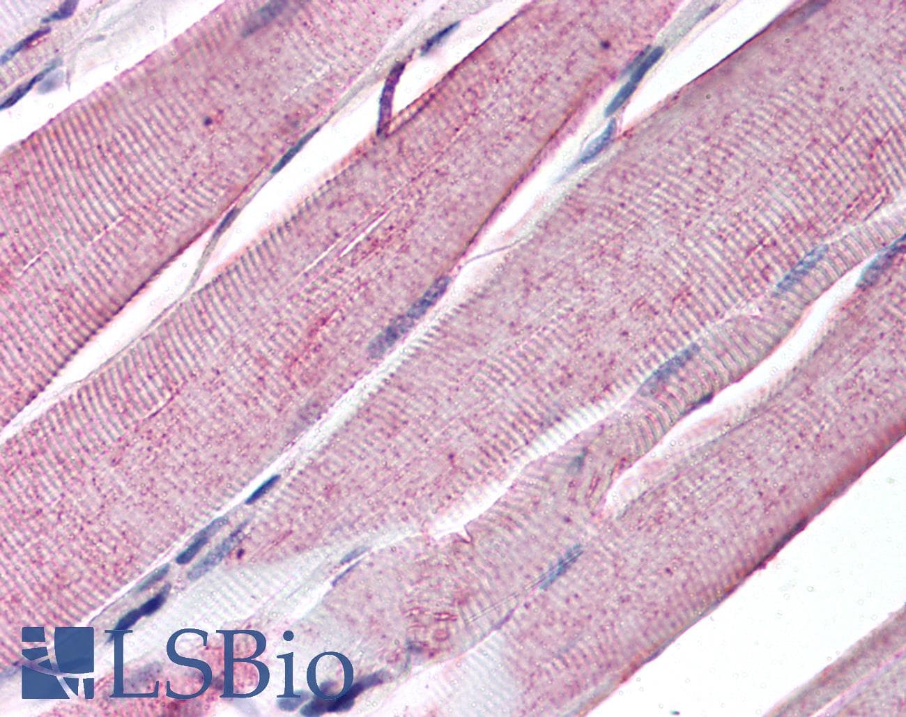 IHC-plus™ MYOG / Myogenin Antibody (aa30-224, clone 5FD)