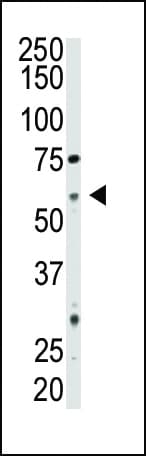 IHC-plus™ NT5E / eNT / CD73 Antibody (aa520-550)