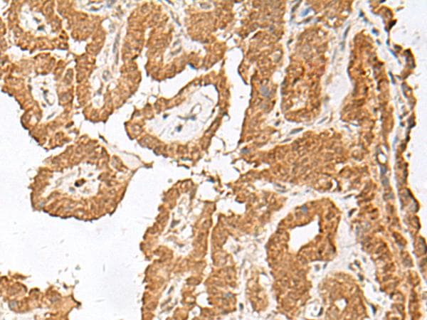 Polyclonal Rabbit anti-Human FGF13 Antibody (IHC)