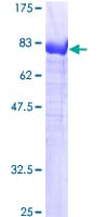 Human ANXA6/Annexin A6/Annexin VI Protein (Recombinant GST)