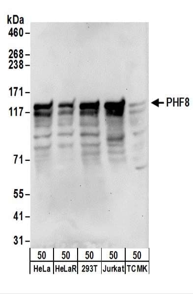 IHC-plus™ PHF8 Antibody (aa650-700)
