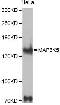 MAP3K5 / ASK1 Antibody