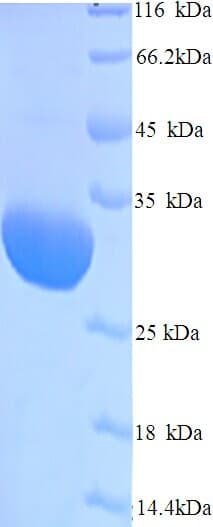 Human Rhinovirus Genome Polyprotein (Recombinant His)