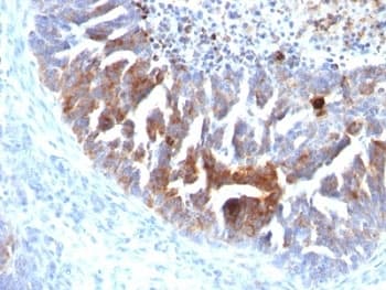 TAG-72 Antibody (clone B72.3 + CC49)