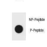 Hamartin / TSC1 Antibody (phospho-Tyr304)