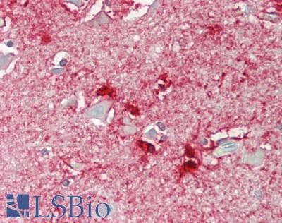 IHC-plus™ ABCA8 Antibody (Internal)