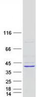 Human LDAH Protein (Recombinant Myc-DDK (Flag))