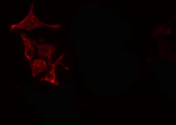 PDGF-BB Antibody